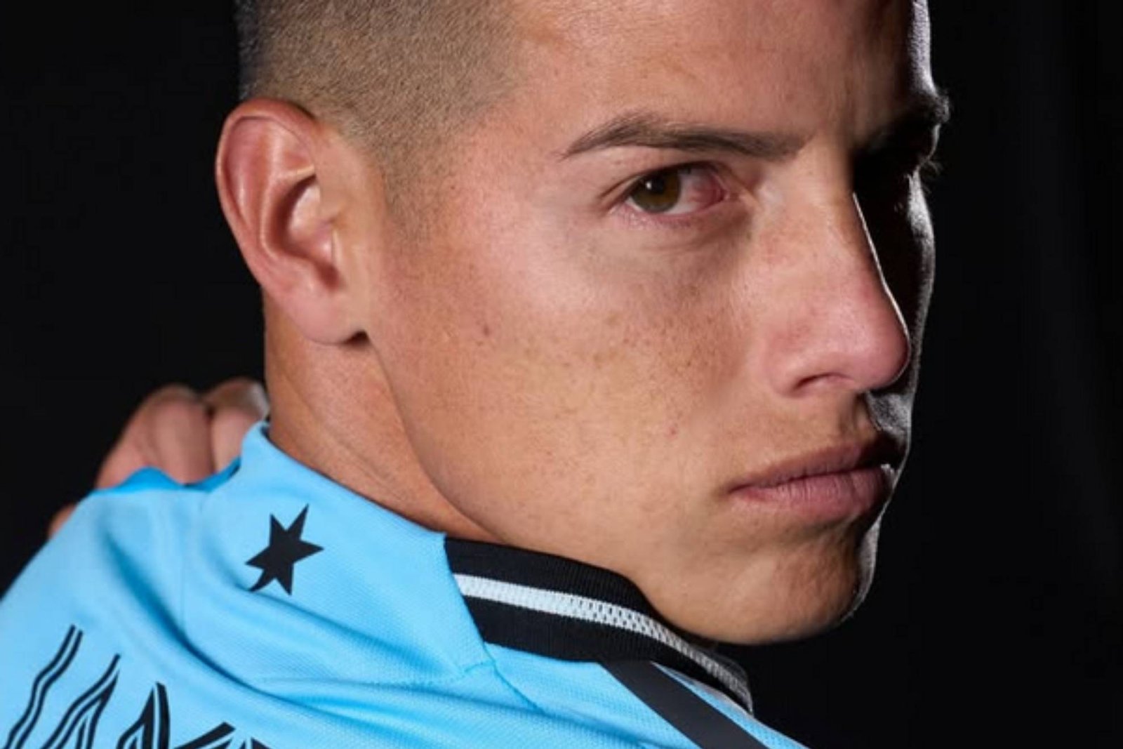 negam-que-james-rodriguez-sofra-de-rabdomiolise,-uma-doenca-potencialmente-fatal